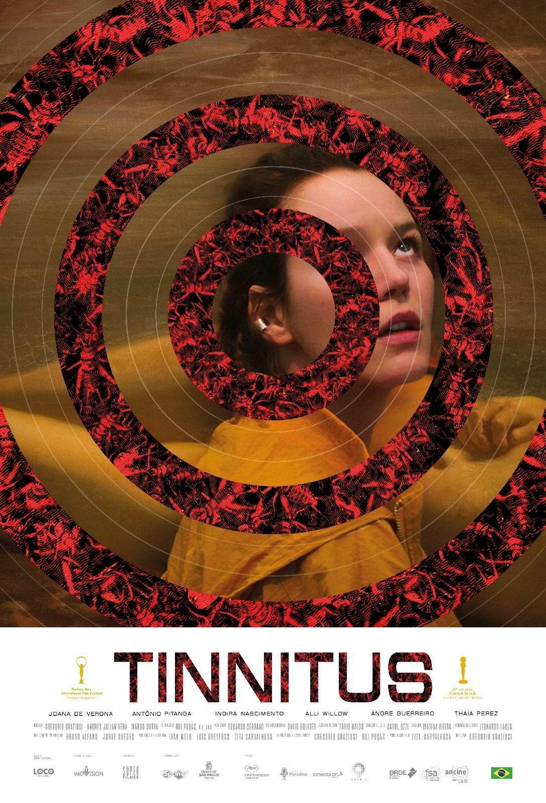 Tinnitus